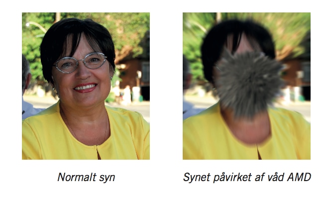 Hvad er våd AMD